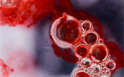 Supervised Learning Predicts Therapeutic Success in Acute Myeloid Leukemia